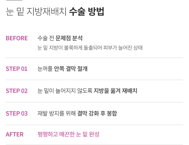 �� �� �������ġ