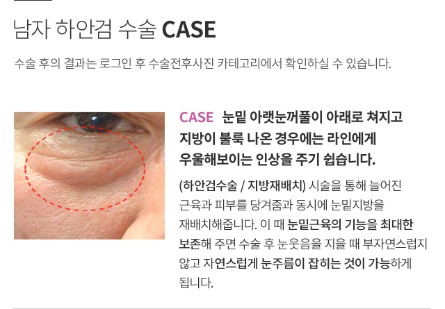 ���� �ϾȰ�