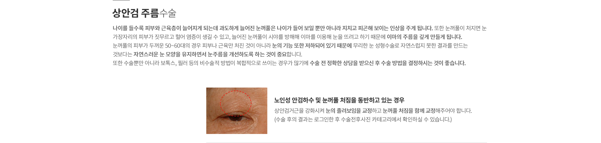 ���̿� ���� ������ ����