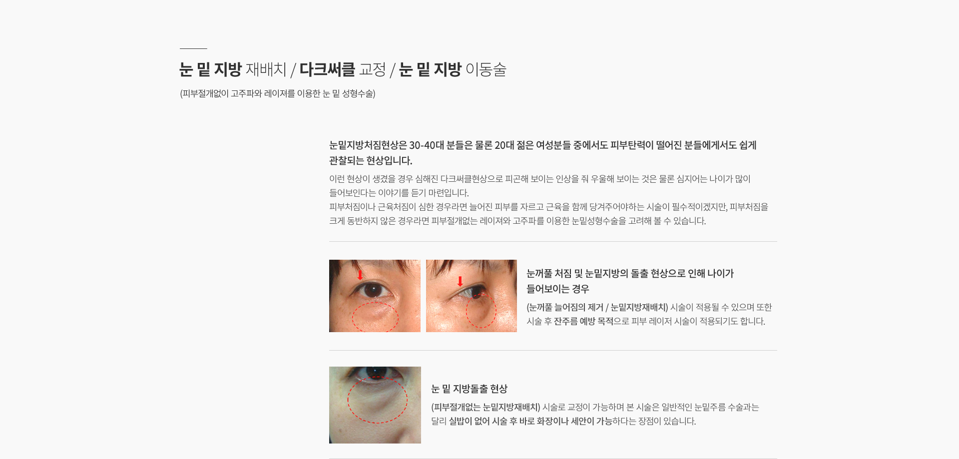 ���̿� ���� ������ ����